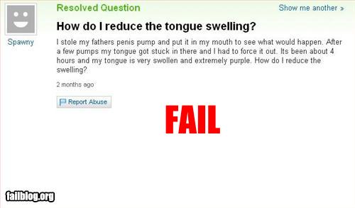 fail-owned-tongue-swelling-fail